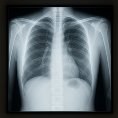 Видно ли на флюорографии, что человек курит вейп?